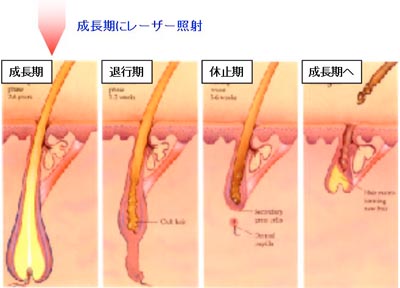 医療脱毛 広尾皮フ科クリニック 美容皮膚科 東京